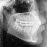 Radiologia Odontológica em Mossoró